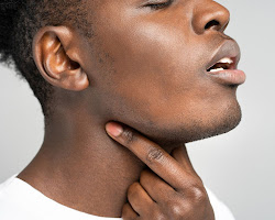 Person with swollen lymph nodes
